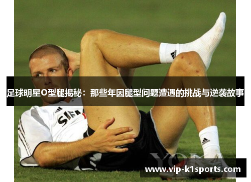 足球明星O型腿揭秘：那些年因腿型问题遭遇的挑战与逆袭故事